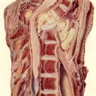 Туберкулез позвоночника: последствия инфекционного поражения костей